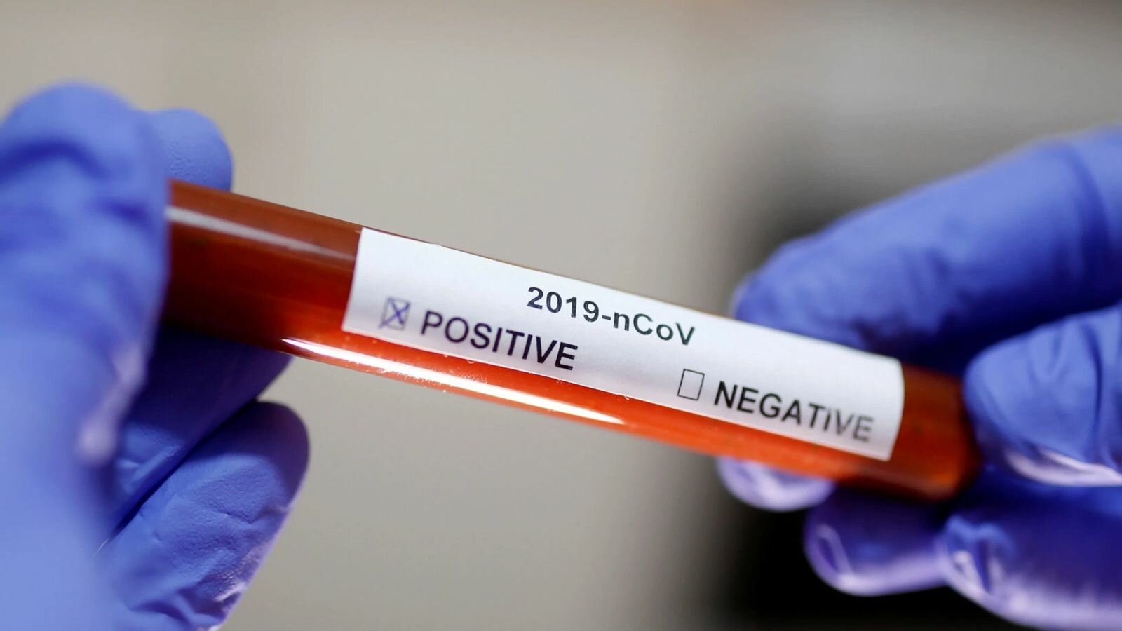 СМИ: в Польше зафиксирован первый случай заражения коронавирусом