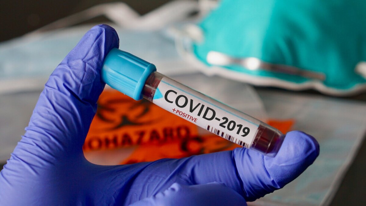 коронавирус, covid-19, франция, предрасположенность, молодые, летальные случаи, генетика