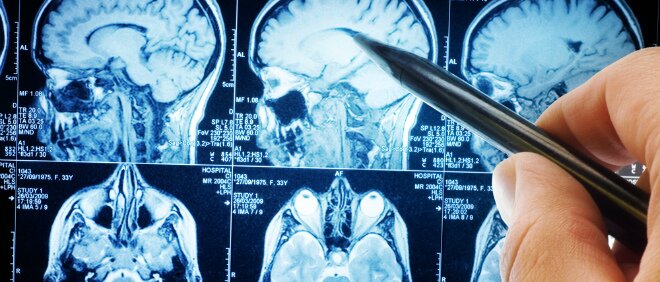 Ученые назвали главную причину возникновения психических заболеваний