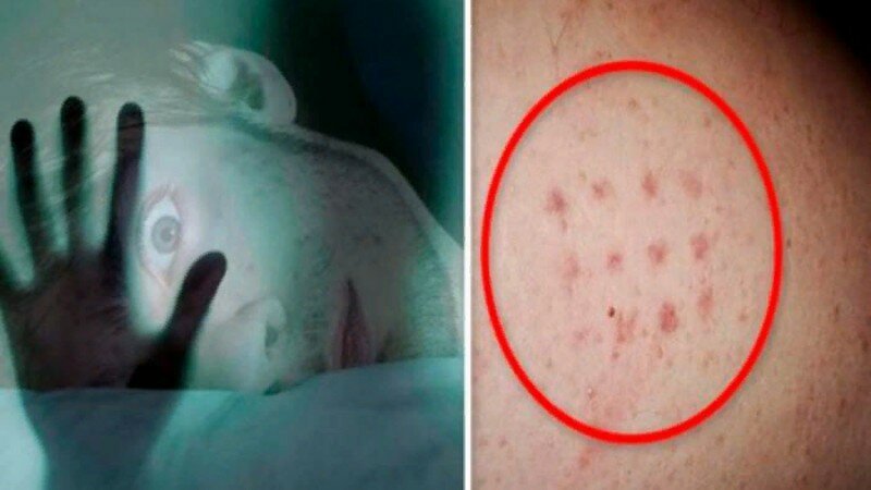Таинственные отметины от гуманоидов: жертвы похищений пришельцев рассказали о клейме на теле