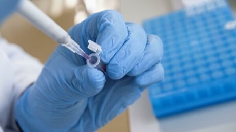Первая смерть от коронавируса зафиксирована в Марий Эл - жертве было 37 лет