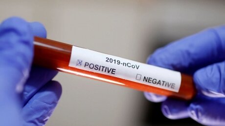 СМИ: в Польше зафиксирован первый случай заражения коронавирусом